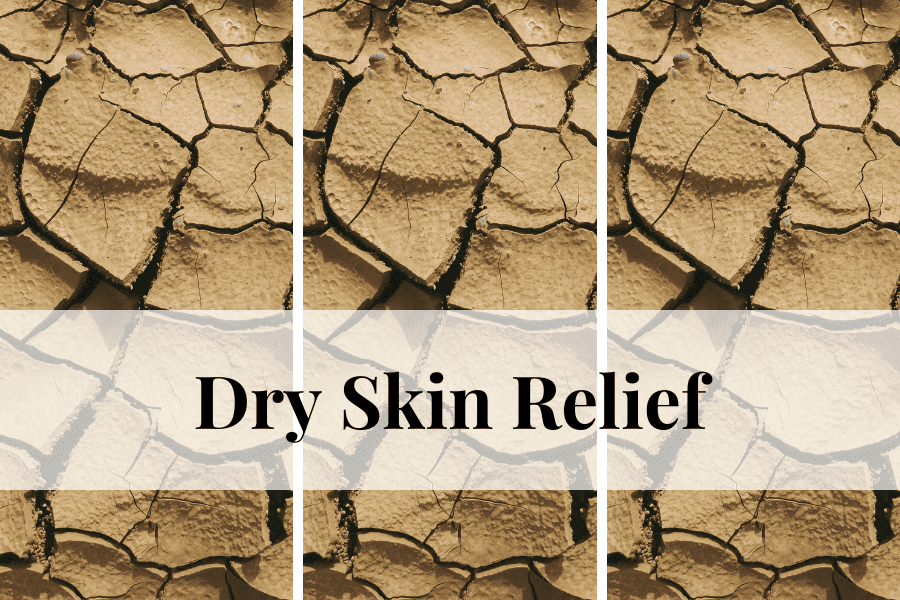 dry skin relief